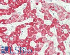 SERPINA4 / Kallistatin Antibody - Human Liver: Formalin-Fixed, Paraffin-Embedded (FFPE)