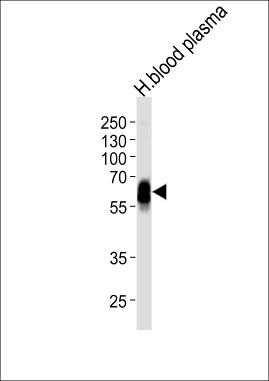 SERPINA6 / CBG Antibody - Western blot of lysate from human blood plasma tissue lysate, using SERPINA6 Antibody. Antibody was diluted at 1:1000 at each lane. A goat anti-rabbit IgG H&L (HRP) at 1:5000 dilution was used as the secondary antibody. Lysate at 35ug per lane.