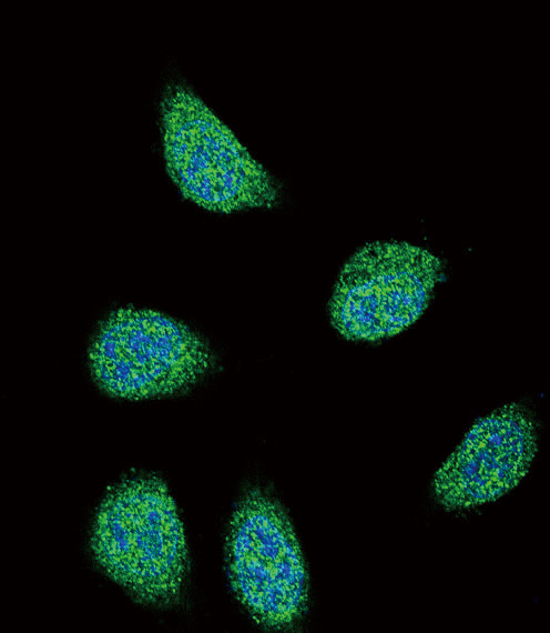SERPINA6 / CBG Antibody - Confocal immunofluorescence of SERPINA6 Antibody with 293 cell followed by Alexa Fluor 488-conjugated goat anti-rabbit lgG (green). DAPI was used to stain the cell nuclear (blue).