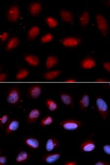 SERPINA6 / CBG Antibody - Immunofluorescence analysis of U20S cell using SERPINA6 antibody. Blue: DAPI for nuclear staining.