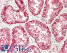 SERPINA6 / CBG Antibody - Human Kidney: Formalin-Fixed, Paraffin-Embedded (FFPE)