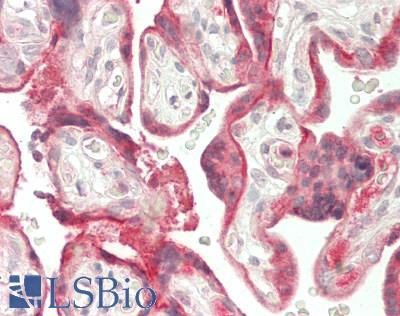 SERPINB2 / PAI-2 Antibody - Human Placenta: Formalin-Fixed, Paraffin-Embedded (FFPE)