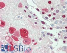 SERPINB2 / PAI-2 Antibody - Anti-SERPINB2 / PAI-2 antibody IHC staining of human placenta. Immunohistochemistry of formalin-fixed, paraffin-embedded tissue after heat-induced antigen retrieval. Antibody concentration 10 ug/ml.