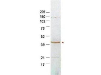 SERPINB2 / PAI-2 Antibody - Anti-PAI-2 antibody - Western Blot. Western blot of affinity purified anti-PAI-2 antibody shows detection of endogenous PAI-2 in 50 ug of HeLa whole cell lysates. The band at ~42 kD (arrowhead) corresponds to PAI-2. Faint non-specific bands are also noted at lower and higher molecular weights positions. Primary antibody was used at a 1:500 dilution in 5% BLOTTO in PBS reacted overnight at 4C. The membrane was washed and reacted with a 1:5000 dilution of HRP- conjugated Gt-a-Rabbit IgG (LS-C60865) for 45 min at room temperature with ECL used for detection. Molecular weight estimation was made by comparison to prestained MW markers. Personal communication, Luca DAgostino, Temple University, Philadelphia, PA.