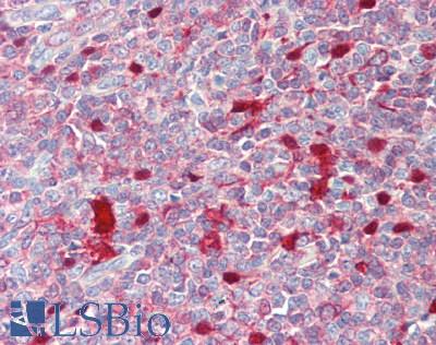 SERPINB9 / PI9 Antibody - Human Tonsil: Formalin-Fixed, Paraffin-Embedded (FFPE), at a concentration of 10 ug/ml. 