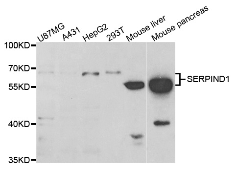 SERPIND1 / Heparin Cofactor 2 Antibody - Western blot analysis of extracts of various cell lines, using SERPIND1 antibody.