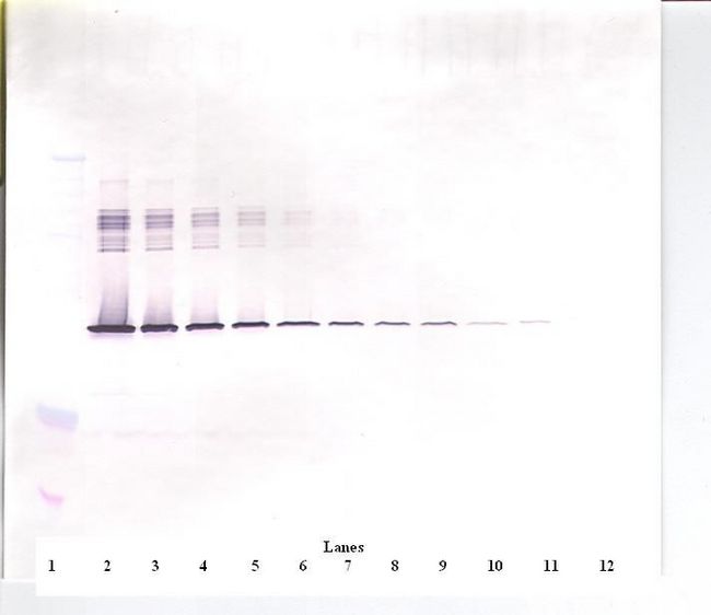 SERPINE1 / PAI-1 Antibody - Western Blot (non-reducing) of SERPINE1 / PAI-1 antibody