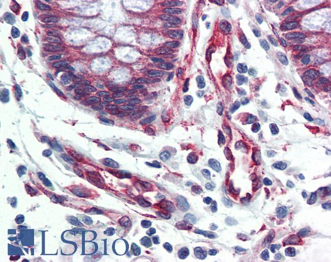 SERPINH1 / HSP47 Antibody - Anti-SERPINH1 / HSP47 antibody IHC of human colon. Immunohistochemistry of formalin-fixed, paraffin-embedded tissue after heat-induced antigen retrieval. Antibody concentration 5 ug/ml.