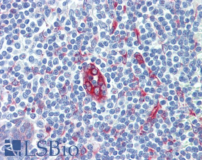 SERPINH1 / HSP47 Antibody - Anti-SERPINH1 / HSP47 antibody IHC of human tonsil. Immunohistochemistry of formalin-fixed, paraffin-embedded tissue after heat-induced antigen retrieval. Antibody concentration 10 ug/ml.