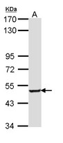 SESN3 Antibody - Sample (30 ug of whole cell lysate). A: Hela. 7.5% SDS PAGE. SESN3 antibody diluted at 1:1000.