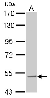 SESN3 Antibody - SESN3 antibody detects SESN3 protein by Western blot analysis. A. 30 ug Rat2 whole cell lysate/extract. 7.5 % SDS-PAGE. SESN3 antibody dilution:1:1000
