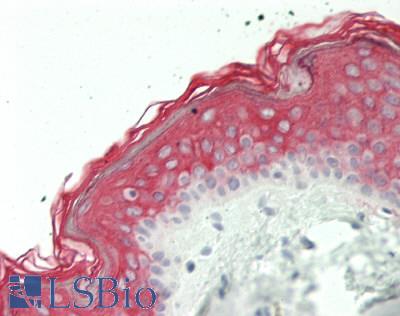 SESN3 Antibody - Human Skin: Formalin-Fixed, Paraffin-Embedded (FFPE)