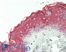 SESN3 Antibody - Human Skin: Formalin-Fixed, Paraffin-Embedded (FFPE)