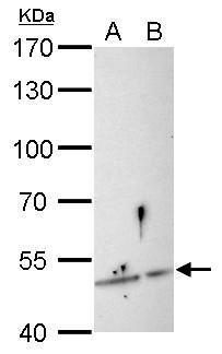SESN3 Antibody - SESN3 antibody detects SESN3 protein by Western blot analysis. A. 30 µg Raw264.7 whole cell lysate/extract B. 30 µg C2C12 whole cell lysate/extract 7.5 % SDS-PAGE SESN3 antibody dilution: 1:500