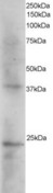 SET / TAF-I Antibody - Antibody staining (2 ug/ml) of Human Kidney extracts (RIPA buffer, 35 ug total protein per lane). Primary incubated for 1 hour. Detected by Western blot of chemiluminescence.