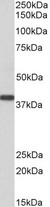 SET / TAF-I Antibody - Goat Anti-SET / I2 alpha PP2A Antibody (0.3?/ml) staining of Human Kidney lysate (35? protein in RIPA buffer). Primary incubation was 1 hour. Detected by chemiluminescence.