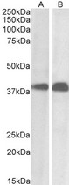 SET / TAF-I Antibody - Goat Anti-SET / I2 alpha PP2A Antibody (0.01?/ml) staining of Daudi (A) and Molt4 (B) cell lysate (35? protein in RIPA buffer). Primary incubation was 1 hour. Detected by chemiluminescence.