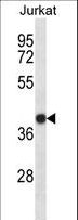 SET / TAF-I Antibody - SET Antibody western blot of Jurkat cell line lysates (35 ug/lane). The SET antibody detected the SET protein (arrow).