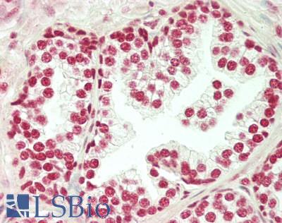 SET / TAF-I Antibody - Human Prostate: Formalin-Fixed, Paraffin-Embedded (FFPE)