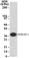 SET / TAF-I Antibody - Western blot of INHAT-1 using antibody against Jurkat cell lysate.