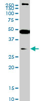 SETD7 / SET7 Antibody - SET7 monoclonal antibody (M01), clone 5B4 Western blot of SET7 expression in Jurkat.