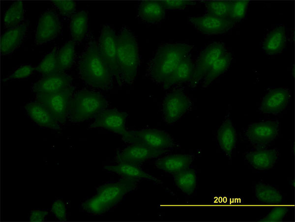 SETD7 / SET7 Antibody - Immunofluorescence of monoclonal antibody to SET7 on HeLa cell. [antibody concentration 10 ug/ml]