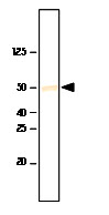 SETD7 / SET7 Antibody - Recombinant SET7/9was resolved by electrophoresis, transferred to PVDF membrane and probed with anti-SET7/9(1:1000). Proteins were visualized using a goat anti-mouse secondary antibody conjugated to HRP and a DAP detection system. Arrow indicated SET7/9(~50Da).
