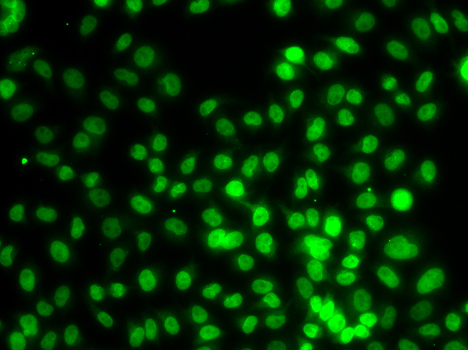 SETD8 / SET8 Antibody - Immunofluorescence analysis of MCF7 cell using SETD8 antibody.