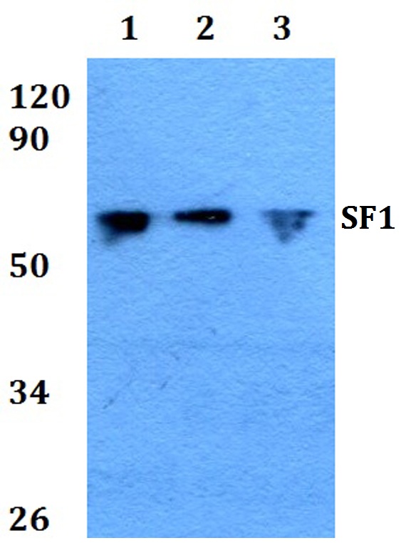 SF1 Antibody - Western blot analysis of SF1 pAb at 1:500 dilution. Lane1: HEK293T whole cell lysate treated with TNFa (20ng/ml,15mins). Lane2: NIH-3T3 whole cell lysate. Lane3: Rat brain tissue lysate.