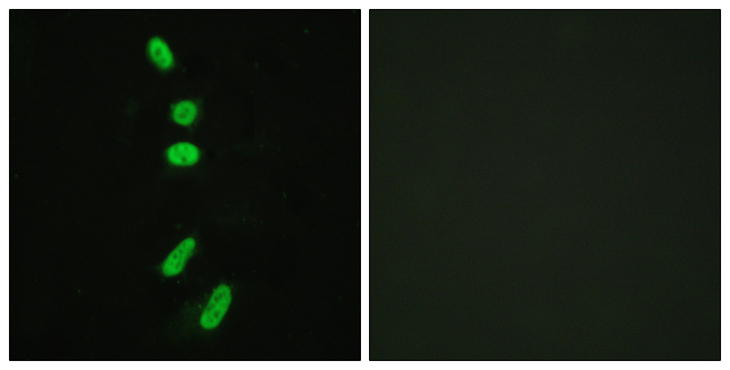 SF1 Antibody - Immunofluorescence analysis of HeLa cells, using SF1 Antibody. The picture on the right is blocked with the synthesized peptide.