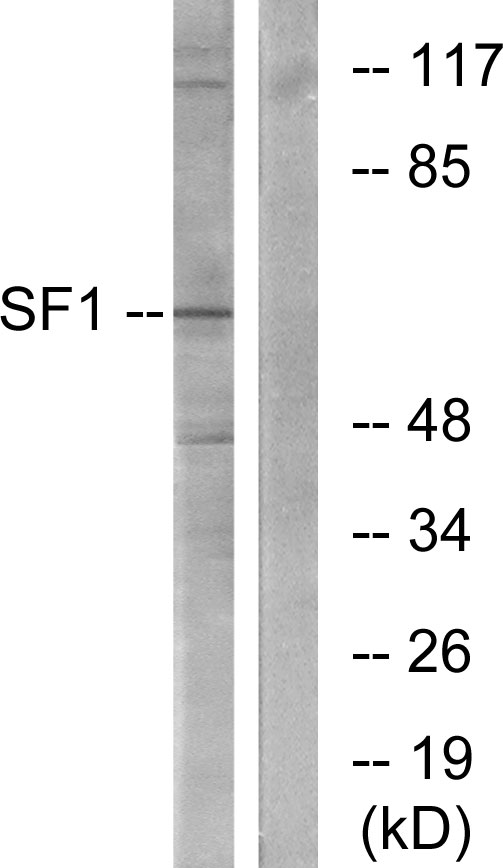 SF1 Antibody - Western blot analysis of lysates from COLO205 cells, using SF1 Antibody. The lane on the right is blocked with the synthesized peptide.