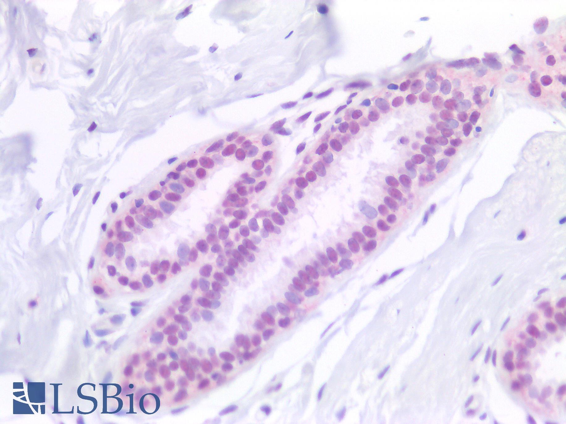 SF1 Antibody - Human Breast: Formalin-Fixed, Paraffin-Embedded (FFPE)