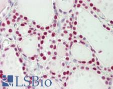 SF3B1 Antibody - Human Thyroid: Formalin-Fixed, Paraffin-Embedded (FFPE)