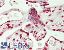 SF3B130 / SF3B3 Antibody - Human Placenta: Formalin-Fixed, Paraffin-Embedded (FFPE)