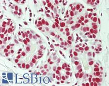 SF3B130 / SF3B3 Antibody - Human Breast: Formalin-Fixed, Paraffin-Embedded (FFPE)