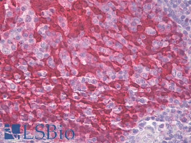 SFN / Stratifin / 14-3-3 Sigma Antibody - Anti-Stratifin / 14-3-3 Sigma antibody IHC of human tonsil, squamous epithelium. Immunohistochemistry of formalin-fixed, paraffin-embedded tissue after heat-induced antigen retrieval. Antibody dilution 10 ug/ml.