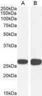 SFN / Stratifin / 14-3-3 Sigma Antibody - Goat Anti-14-3-3 sigma / Stratifin Antibody (0.03µg/ml) staining of A431 (A) and U2OS (B) cell lysate (35µg protein in RIPA buffer). Detected by chemiluminescencence.