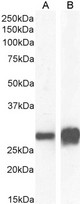 SFN / Stratifin / 14-3-3 Sigma Antibody - Goat Anti-14-3-3 sigma / Stratifin Antibody (0.03µg/ml) staining of Mouse (A) and Rat (B) Skin lysate (35µg protein in RIPA buffer). Detected by chemiluminescencence.