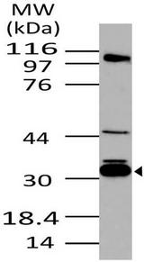 SFN / Stratifin / 14-3-3 Sigma Antibody - Fig-1: Western blot analysis of 14-3-3 sigma . Anti- 14-3-3 sigma antibody was used at 1 µg/ml on Molt-4 lysate.