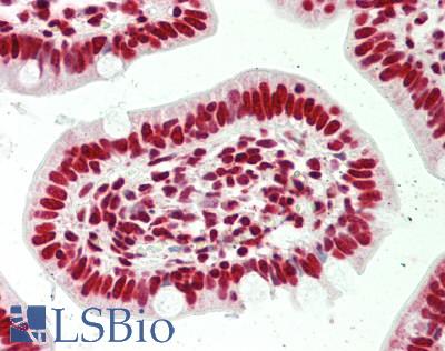 SFPQ Antibody - Human Small Intestine: Formalin-Fixed, Paraffin-Embedded (FFPE)