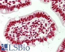 SFPQ Antibody - Human Small Intestine: Formalin-Fixed, Paraffin-Embedded (FFPE)