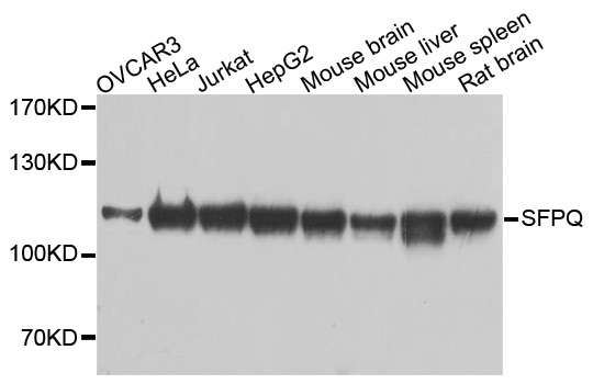SFPQ Antibody - Western blot analysis of extracts of various cell lines, using SFPQ antibody at 1:1000 dilution. The secondary antibody used was an HRP Goat Anti-Rabbit IgG (H+L) at 1:10000 dilution. Lysates were loaded 25ug per lane and 3% nonfat dry milk in TBST was used for blocking. An ECL Kit was used for detection and the exposure time was 1s.