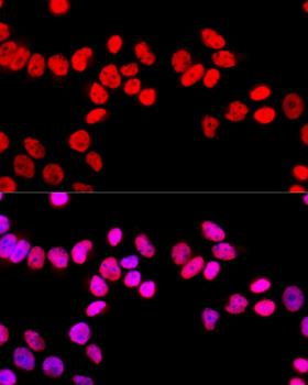 SFPQ Antibody - Immunofluorescence analysis of HeLa cells using SFPQ antibodyat dilution of 1:100 (40x lens). Blue: DAPI for nuclear staining.