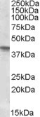 SFRP4 Antibody - SFRP4 antibody (0.3 ug/ml) staining of human uterus lysate (35 ug protein/ml in RIPA buffer). Primary incubation was 1 hour. Detected by chemiluminescence.