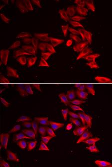 SFRP4 Antibody - Immunofluorescence analysis of HeLa cell using SFRP4 antibody. Blue: DAPI for nuclear staining.