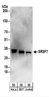 SFRS7 / 9G8 Antibody - Detection of Human SRSF7 by Western Blot. Samples: Whole cell lysate (50 ug) from HeLa, 293T, and Jurkat cells. Antibodies: Affinity purified rabbit anti-SRSF7 antibody used for WB at 0.1 ug/ml. Detection: Chemiluminescence with an exposure time of 3 minutes.