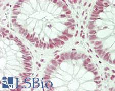 SFRS7 / 9G8 Antibody - Human Colon: Formalin-Fixed, Paraffin-Embedded (FFPE)