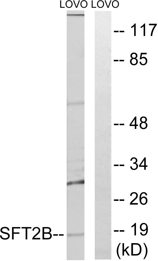 SFT2D2 Antibody - Western blot analysis of lysates from LOVO cells, using SFT2B Antibody. The lane on the right is blocked with the synthesized peptide.