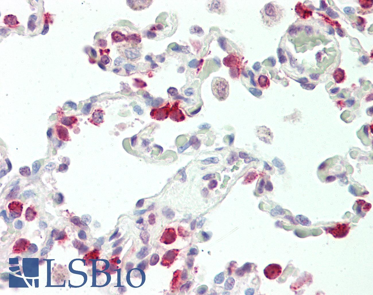 SFTPC / Surfactant Protein C Antibody - Anti-SFTPC / Surfactant Protein C antibody IHC staining of human lung. Immunohistochemistry of formalin-fixed, paraffin-embedded tissue after heat-induced antigen retrieval. Antibody dilution 1:100.