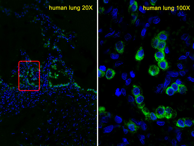 SFTPC / Surfactant Protein C Antibody - Immunofluorescence of Human lung tissues, using SFTPC Antibody. Antibody was diluted at 1:25 dilution. Alexa Fluor 488-conjugated goat anti-rabbit lgG at 1:400 dilution was used as the secondary antibody (green). DAPI was used to stain the cell nuclear (blue).